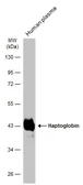 Anti-Haptoglobin antibody used in Western Blot (WB). GTX103894