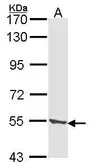 Anti-TPP1 antibody used in Western Blot (WB). GTX103896