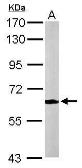 Anti-MPP2 antibody [N1C3] used in Western Blot (WB). GTX103908