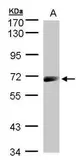 Anti-IL12 Receptor beta1 antibody [N1C2] used in Western Blot (WB). GTX103917