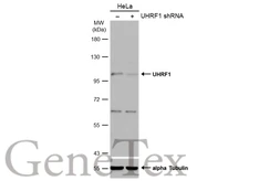 Anti-UHRF1 antibody used in Western Blot (WB). GTX103925