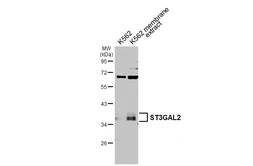 Anti-ST3GAL2 antibody [N2C3] used in Western Blot (WB). GTX103942