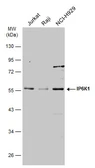 Anti-IP6K1 antibody used in Western Blot (WB). GTX103949