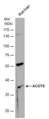 Anti-ACOT8 antibody [N1C3] used in Western Blot (WB). GTX103960