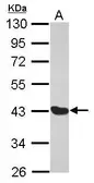 Anti-MAGE 1 antibody [N1C3] used in Western Blot (WB). GTX103961