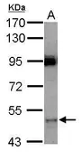 Anti-CYP3A7 antibody [N3C3] used in Western Blot (WB). GTX103969