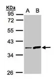 Anti-Prostasin antibody [N1C2] used in Western Blot (WB). GTX103976
