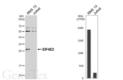 Anti-EIF4E2 antibody [N1C3] used in Western Blot (WB). GTX103977