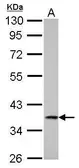 Anti-Cathepsin S antibody used in Western Blot (WB). GTX103988