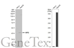 Anti-HPD antibody [N1C2] used in Western Blot (WB). GTX103994
