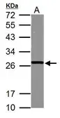 Anti-GSTM5 antibody used in Western Blot (WB). GTX103998