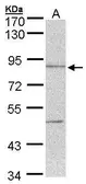 Anti-Thimet Oligopeptidase antibody [N2C2], Internal used in Western Blot (WB). GTX104000