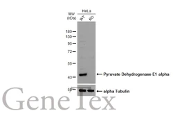 Anti-Pyruvate Dehydrogenase E1 alpha antibody used in Western Blot (WB). GTX104015