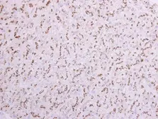 Anti-ST6GAL1 antibody [N2C3] used in IHC (Paraffin sections) (IHC-P). GTX104018