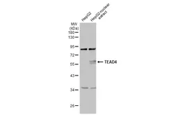 Anti-TEAD4 antibody used in Western Blot (WB). GTX104026