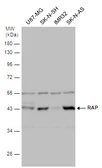 Anti-LRPAP1 antibody [N1C3] used in Western Blot (WB). GTX104033