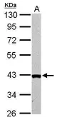 Anti-ARG2 antibody used in Western Blot (WB). GTX104036