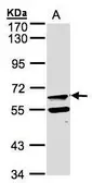 Anti-FPGT antibody [N2C2], Internal used in Western Blot (WB). GTX104056