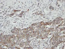 Anti-PON2 antibody [N1C2] used in IHC (Paraffin sections) (IHC-P). GTX104061
