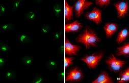 Anti-GALNT2 antibody used in Immunocytochemistry/ Immunofluorescence (ICC/IF). GTX104070