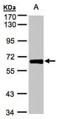 Anti-ZNF169 antibody [N3C3] used in Western Blot (WB). GTX104071