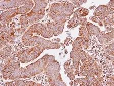 Anti-IDH3A antibody used in IHC (Paraffin sections) (IHC-P). GTX104073