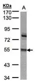 Anti-ZNF165 antibody [N2C3] used in Western Blot (WB). GTX104092