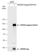 Anti-EphA4 antibody [N3C2], Internal used in Western Blot (WB). GTX104109