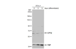 Anti-CPT2 antibody [N1C1] used in Western Blot (WB). GTX104115