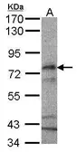 Anti-CPT2 antibody [N1C1] used in Western Blot (WB). GTX104115