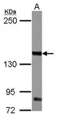 Anti-IL3 Receptor beta antibody [N1N3] used in Western Blot (WB). GTX104118