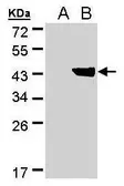 Anti-DHDH antibody [N1C3] used in Western Blot (WB). GTX104120