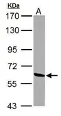 Anti-ME1 antibody used in Western Blot (WB). GTX104122