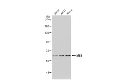 Anti-ME1 antibody used in Western Blot (WB). GTX104122