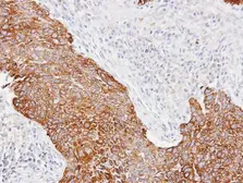 Anti-Cytokeratin 14 antibody used in IHC (Paraffin sections) (IHC-P). GTX104124