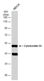 Anti-Cytokeratin 14 antibody used in Western Blot (WB). GTX104124