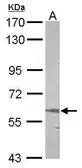 Anti-ALAS-E antibody [N3C3] used in Western Blot (WB). GTX104139