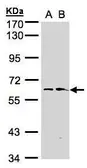 Anti-FMO1 antibody [N1C2] used in Western Blot (WB). GTX104172