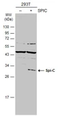 Anti-Spi-C antibody used in Western Blot (WB). GTX104182