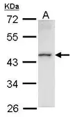 Anti-HMBOX1 antibody [N3C3] used in Western Blot (WB). GTX104189