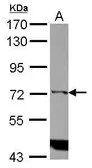 Anti-IP3KC antibody [N3C2], Internal used in Western Blot (WB). GTX104192