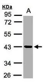 Anti-Kallikrein 11 antibody [N1C3] used in Western Blot (WB). GTX104200