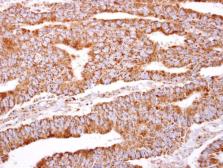 Anti-PACSIN2 antibody [N2C3] used in IHC (Paraffin sections) (IHC-P). GTX104204