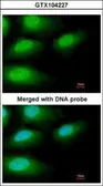Anti-IRAK3 antibody [N1C1] used in Immunocytochemistry/ Immunofluorescence (ICC/IF). GTX104227