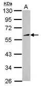 Anti-KLF12 antibody used in Western Blot (WB). GTX104232