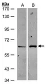 Anti-ZSCAN5 antibody [N2C3] used in Western Blot (WB). GTX104236