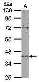 Anti-RCL1 antibody [N1C3] used in Western Blot (WB). GTX104252