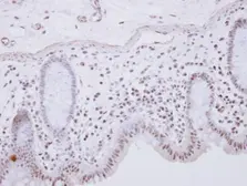 Anti-RCL1 antibody [N1C3] used in IHC (Paraffin sections) (IHC-P). GTX104252