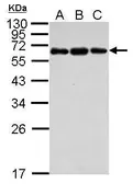 Anti-C4 binding protein B antibody used in Western Blot (WB). GTX104277