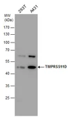 Anti-TMPRSS11D antibody used in Western Blot (WB). GTX104290